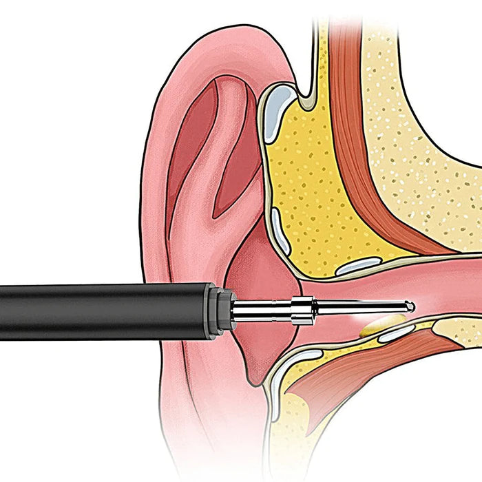 Oz Smart Ear Wax Cleaner